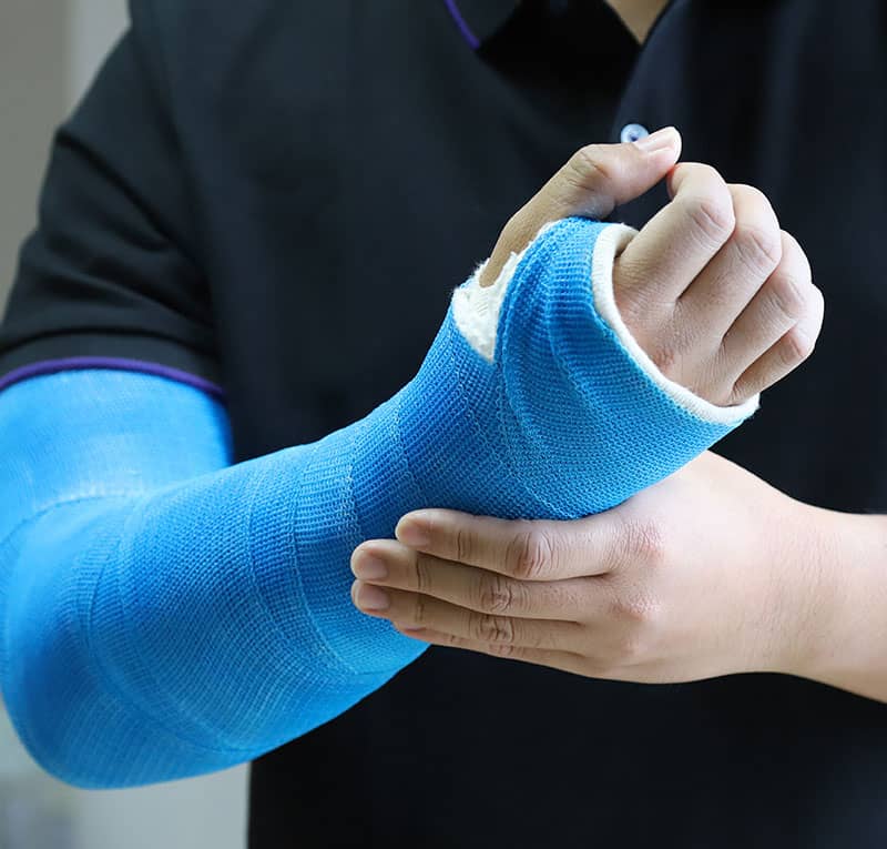 Someone holding their arm which is bound in a blue cast.